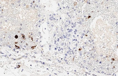 Anti-SARS-CoV / SARS-CoV-2 (COVID-19) spike antibody [1A9] used in IHC (Paraffin sections) (IHC-P). GTX632604