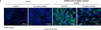 Anti-SARS-CoV / SARS-CoV-2 (COVID-19) spike antibody [1A9] used in Immunocytochemistry/ Immunofluorescence (ICC/IF). GTX632604