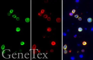 Anti-SARS-CoV / SARS-CoV-2 (COVID-19) spike antibody [1A9] used in IHC-P (cell pellet) (IHC-P (cell pellet)). GTX632604