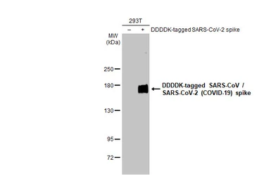 Anti-SARS-CoV / SARS-CoV-2 (COVID-19) spike antibody [1A9] used in Western Blot (WB). GTX632604
