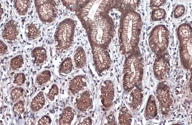 Anti-beta Catenin antibody [GT3171] used in IHC (Paraffin sections) (IHC-P). GTX632676