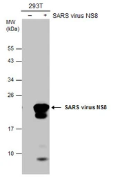 Anti-SARS-CoV / SARS-CoV-2 (COVID-19) nsp8 antibody [5A10] used in Western Blot (WB). GTX632696