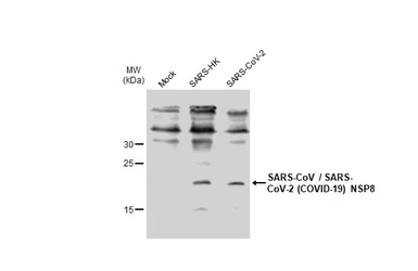 Anti-SARS-CoV / SARS-CoV-2 (COVID-19) nsp8 antibody [5A10] used in Western Blot (WB). GTX632696