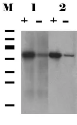 Anti-SGTA antibody [6A4] used in Western Blot (WB). GTX632697