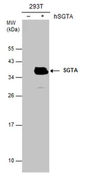 Anti-SGTA antibody [6A4] used in Western Blot (WB). GTX632697