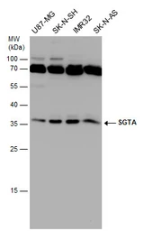 Anti-SGTA antibody [6A4] used in Western Blot (WB). GTX632697