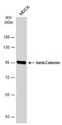 Anti-beta Catenin antibody [GT2169] used in Western Blot (WB). GTX633010