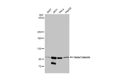 Anti-beta Catenin antibody [GT2169] used in Western Blot (WB). GTX633010