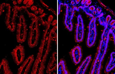 Anti-beta Catenin antibody [GT2169] used in IHC (Paraffin sections) (IHC-P). GTX633010