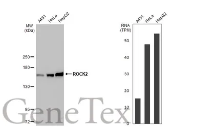 Anti-ROCK2 antibody [GT11712] used in Western Blot (WB). GTX633389
