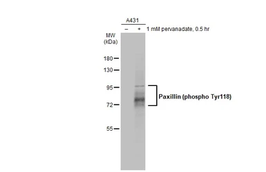 Anti-Paxillin (phospho Tyr118) antibody [GT712] used in Western Blot (WB). GTX633633