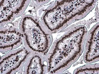 Anti-Histone H3K27ac (Acetyl Lys27) antibody [GT261] used in IHC (Paraffin sections) (IHC-P). GTX633652