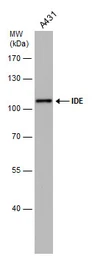 Anti-IDE antibody [GT143] used in Western Blot (WB). GTX633694