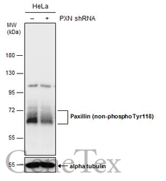 Anti-Paxillin (non-phospho Tyr118) antibody [GT722] used in Western Blot (WB). GTX633707