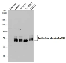 Anti-Paxillin (non-phospho Tyr118) antibody [GT722] used in Western Blot (WB). GTX633707