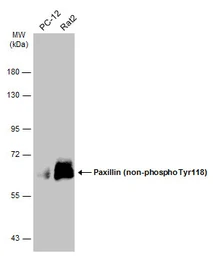 Anti-Paxillin (non-phospho Tyr118) antibody [GT722] used in Western Blot (WB). GTX633707