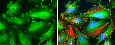Anti-Paxillin (non-phospho Tyr118) antibody [GT722] used in Immunocytochemistry/ Immunofluorescence (ICC/IF). GTX633707