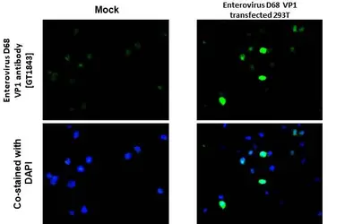 Anti-Enterovirus D68 VP1 antibody [GT1843] used in IHC-P (cell pellet) (IHC-P (cell pellet)). GTX633770