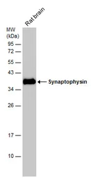 Anti-Synaptophysin antibody [GT1825] used in Western Blot (WB). GTX633821