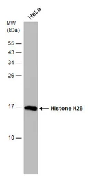 Anti-Histone H2B antibody [GT387] used in Western Blot (WB). GTX633909