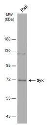 Anti-Syk antibody [GT351] used in Western Blot (WB). GTX633910