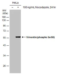 Anti-Vimentin (phospho Ser56) antibody [GT11512] used in Western Blot (WB). GTX633923