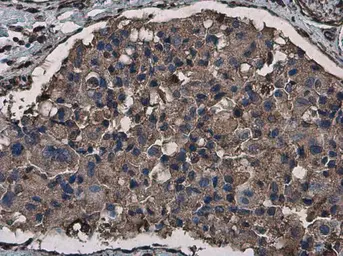 Anti-Vimentin (phospho Ser56) antibody [GT11512] used in IHC (Paraffin sections) (IHC-P). GTX633923