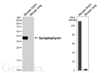 Anti-Synaptophysin antibody [GT2589] used in Western Blot (WB). GTX633972