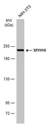 Anti-MYH10 antibody [GT324] used in Western Blot (WB). GTX634139