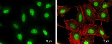 Anti-Cullin 4a antibody [GT885] used in Immunocytochemistry/ Immunofluorescence (ICC/IF). GTX634164