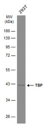 Anti-TBP antibody [GT453] used in Western Blot (WB). GTX634166