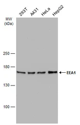 Anti-EEA1 antibody [GT10811] used in Western Blot (WB). GTX634169