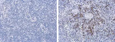 Anti-Porcine circovirus type 2 / PCV2 Capsid antibody [GT863] used in IHC (Paraffin sections) (IHC-P). GTX634210