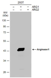 Anti-Arginase 1 antibody [GT5811] used in Western Blot (WB). GTX634218