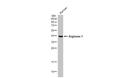 Anti-Arginase 1 antibody [GT5811] used in Western Blot (WB). GTX634218