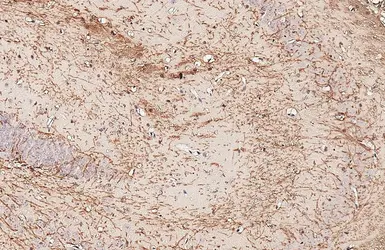 Anti-Myelin basic protein antibody [GT3412] used in IHC (Paraffin sections) (IHC-P). GTX634292