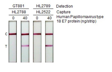 Anti-Human Papillomavirus type 18 E7 antibody [GT881] used in Lateral Flow (Lateral Flow). GTX634337