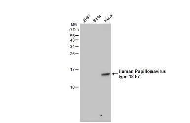 Anti-Human Papillomavirus type 18 E7 antibody [GT881] used in Western Blot (WB). GTX634337