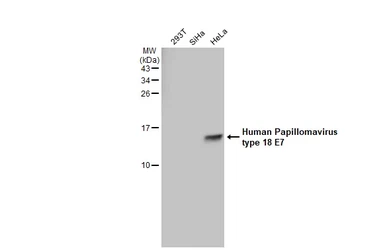 Anti-Human Papillomavirus type 18 E7 antibody [GT881] used in Western Blot (WB). GTX634337