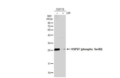 Anti-HSP27 (phospho Ser82) antibody [GT357] used in Western Blot (WB). GTX634421