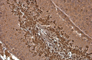 Anti-PGK1 antibody [GT21612] used in IHC (Paraffin sections) (IHC-P). GTX634447