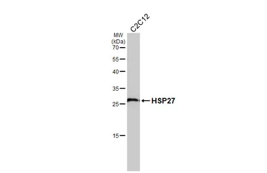 Anti-HSP27 antibody [GT6310] used in Western Blot (WB). GTX634459