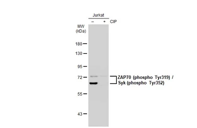 Anti-ZAP70 (phospho Tyr319) / Syk (phospho Tyr352) antibody [GT1686] used in Western Blot (WB). GTX634484