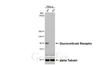 Anti-Glucocorticoid Receptor antibody [GT248] used in Western Blot (WB). GTX634647
