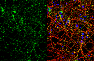 Anti-VAMP2 antibody [GT766] used in Immunocytochemistry/ Immunofluorescence (ICC/IF). GTX634829