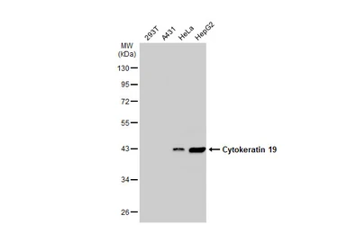 Anti-Cytokeratin 19 antibody [GT147] used in Western Blot (WB). GTX635163
