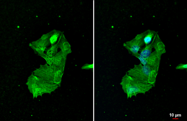 Anti-Cytokeratin 19 antibody [GT147] used in Immunocytochemistry/ Immunofluorescence (ICC/IF). GTX635163