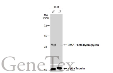 Anti-DAG1 / beta Dystroglycan antibody [GT9112] used in Western Blot (WB). GTX635178