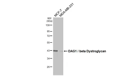 Anti-DAG1 / beta Dystroglycan antibody [GT835] used in Western Blot (WB). GTX635179