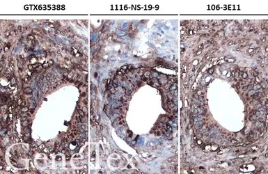 Anti-CA19-9 antibody [GT174] used in IHC (Paraffin sections) (IHC-P). GTX635388